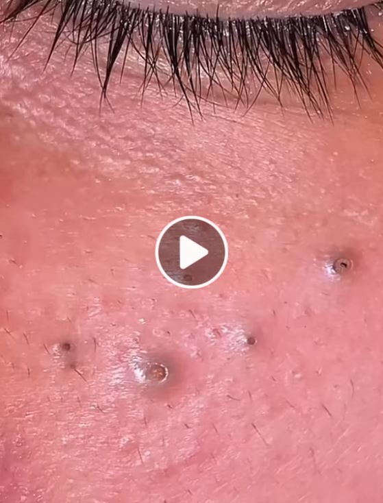 The Call of the Wild